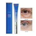 Eye Firming Electric Eye Frost Puffiness and Moisturizing Eye Firming