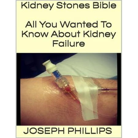 Kidney Stones Bible: All You Wanted to Know About Kidney Failure - (Best Way To Dissolve Kidney Stones)