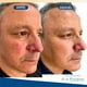 thumbnail image 2 of Removedor De Verrugas Aceite de eliminación de verrugas líquido de suero de eliminación de manchas oscuras de 20ml portátil para tratamiento facial Tmvgtek Cuidado Belleza, 2 of 9
