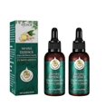 thumbnail image 1 of Productos PARA EL CRECIMIENTO DEL cabello Yuxing con jengibre SUERO líquido anticaída, 1 of 5