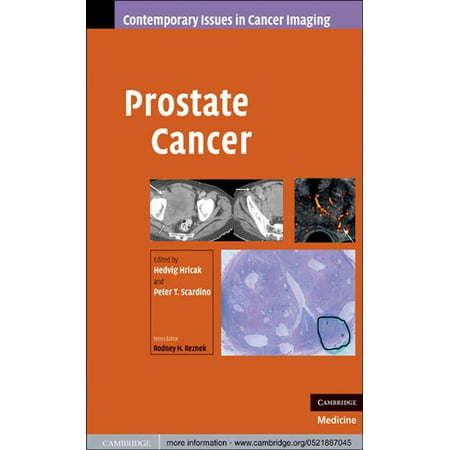 Prostate Cancer - eBook