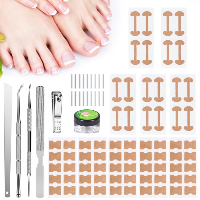 Kit de eliminación de uñas encarnadas con tiras para uñas encarnadas, parche corrector para uñas curvas, lima para uñas y herramientas para pedicura para mujer y hombre