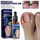 thumbnail image 3 of Toenail Nail Fungus Treatment Repair Fingernail Device Toenail Treatment for Foot Nail Fungus Essential Oil Onychomycosis Care, 3 of 5