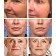 thumbnail image 4 of IBeaLee Retinol essence Solution Moisturizing, Firming and Shrinking Pore Vial essence, 4 of 5