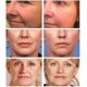 thumbnail image 4 of IBeaLee Retinol essence Solution Moisturizing, Firming and Shrinking Pore Vial essence, 4 of 5