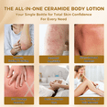 thumbnail image 3 of OUKEYA Daily Use Hydrating 5 Essential Ceramides & Hyaluronic Acid Body Lotion 9.47 fl oz, 3 of 6