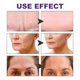thumbnail image 5 of 100 Uds Cara Frente Mejilla Barbilla Pegatina Reutilizable Suave Forma V Parches para Ojos, 5 of 7