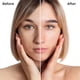 thumbnail image 3 of TOLEVITA - Parches antiarrugas en la frente | Eliminador de líneas de frente | Parches antiarrugas para suavizar las líneas finas con hidrogel de extracto de aloe, colágeno, vitamina E para todo tipo, 3 of 5