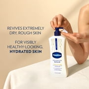 Vaseline Advanced Repair Body Lotion for Dry Skin Advanced Repair Unscented Lotion Made with Ultra-Hydrating Lipids and Vaseline® Jelly That Repairs Extremely Dry Skin,20.3 fl oz