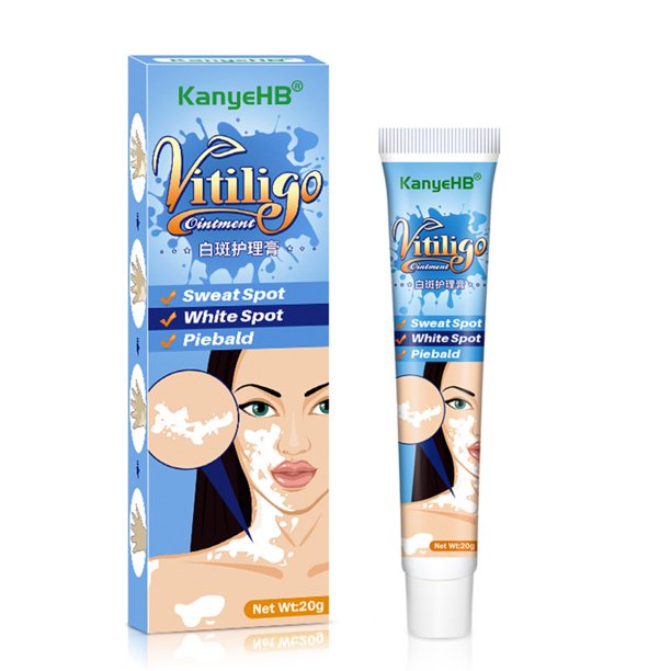 Vitiligo Removal Cream Skin Care for Hand and Facial