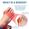 thumbnail image 3 of Foot Bunions Correction Sleeve, 3 of 3