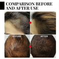 thumbnail image 5 of 2 piezas de suero anti-encanecimiento para el cabello Suero anti-encanecimiento para el cabello Suero anti-encanecimiento para el cabello para hombres y mujeres, 5 of 5