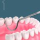 thumbnail image 5 of Herramientas de limpieza de dientes Chude de acero inoxidable 304, 7 piezas, 5 of 7