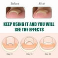 thumbnail image 5 of Pasta para el cuidado de las uñas, cuidado suave para las uñas de los pies, alta protección, cobertura suave y cómoda, firmeza y no se cae fácilmente. Parche para el cuidado de las uñas., 5 of 5