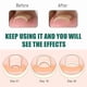 thumbnail image 5 of Pasta para el cuidado de las uñas. Cuidado suave. Uñas de los pies. Alta protección. Cobertura suave y cómoda. Protección firme que no se desprende fácilmente. Parche para el cuidado de las uñas., 5 of 5