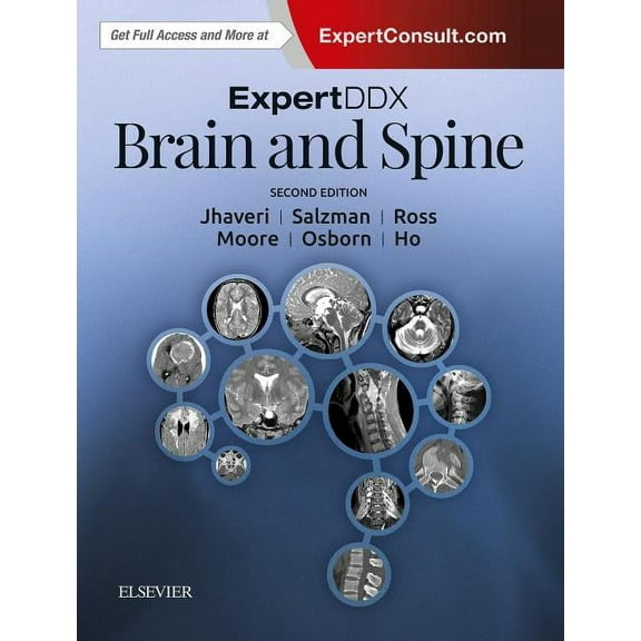 EXPERTddx: Expertddx: Brain and Spine (Hardcover)