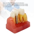 thumbnail image 4 of Modelo De Implante Dental, Resina De Modelo De Dientes De Implante Seguro Para Educación, 4 of 7