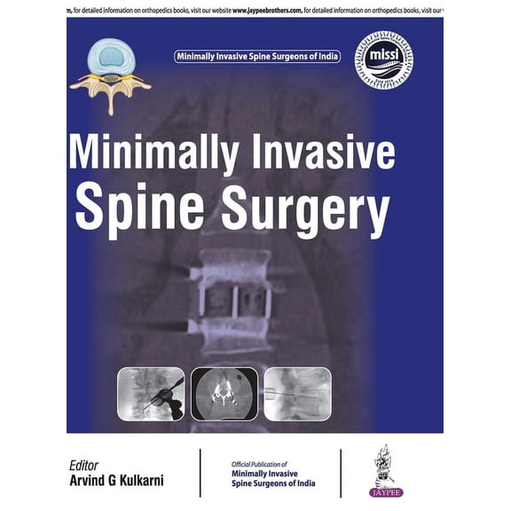 Minimally Invasive Spine Surgery, (Hardcover)