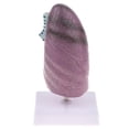 thumbnail image 3 of 2: 3 Modelo Reproducción de Patología de Estructura Pulmonar Exhibición para Enseñanza Médica Escolar Baoblaze Estatua humana del pulmón, 3 of 8