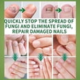 thumbnail image 4 of Ginger Nail Fungus Treatment Extra Strength, Anti Fungal Nail Treatment for Toenails and Fingernails, Toenail Fungal Treatment for Nail Repair, 4 of 5