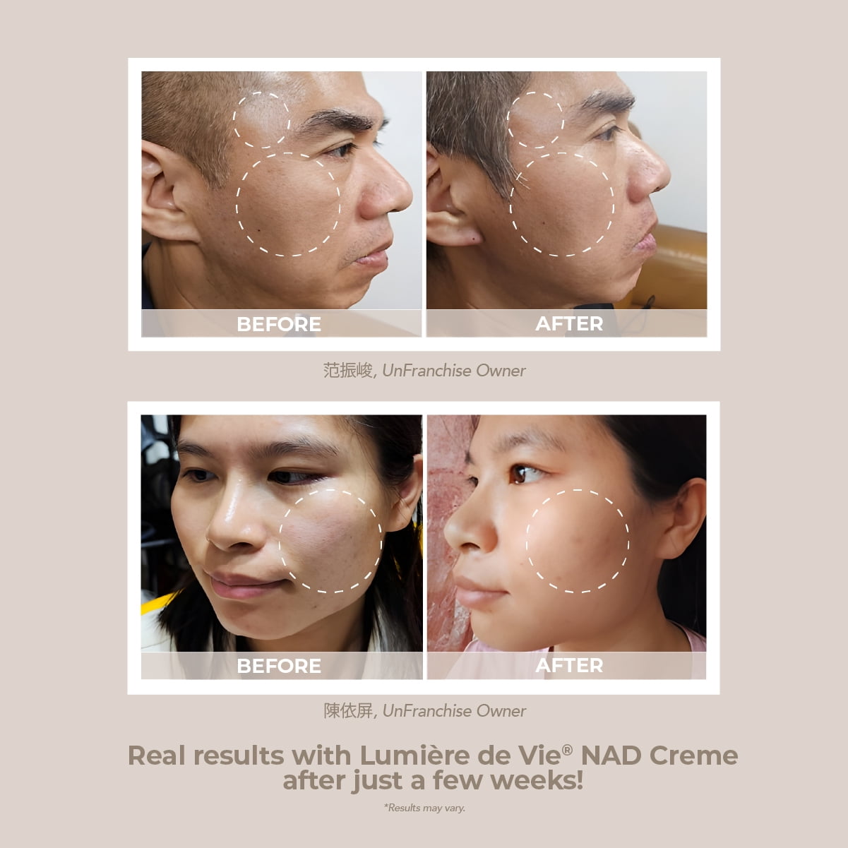 LUMIÈRE DE VIE® NAD Crème – Face Cream with 5% Myristyl Nicotinate, Supports Healthy NAD Levels, Smooths the Look of Fine Lines, Helps Improve Elasticity & Hydration, 40g