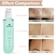 thumbnail image 5 of Skin Scrubber MISERWE, espátula facial, limpiador de poros, 4 modos, 5 of 7