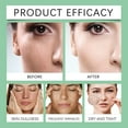 thumbnail image 6 of Moisturizing Cream - Hydration And Repair For Dry All-Day Suitable For All Types, 6 of 8