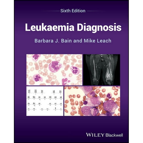 Leukaemia Diagnosis, (Hardcover)