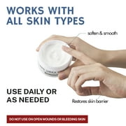 OUKEYA Urea Cream 40% Exfoliating Moisturizer, Hydration, 4 Pack