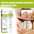 thumbnail image 3 of Gel de eliminación de hongos en las uñas ungüento antihongos para el cuidado de las uñas esencia nutritiva para el cuidado de las uñas, 3 of 9