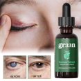 thumbnail image 2 of Jimerito Soursop Extract Eye Care Solution - Natural Moisturizing, Reduces Dark Circles, Wrinkles, 30ml, 2 of 5