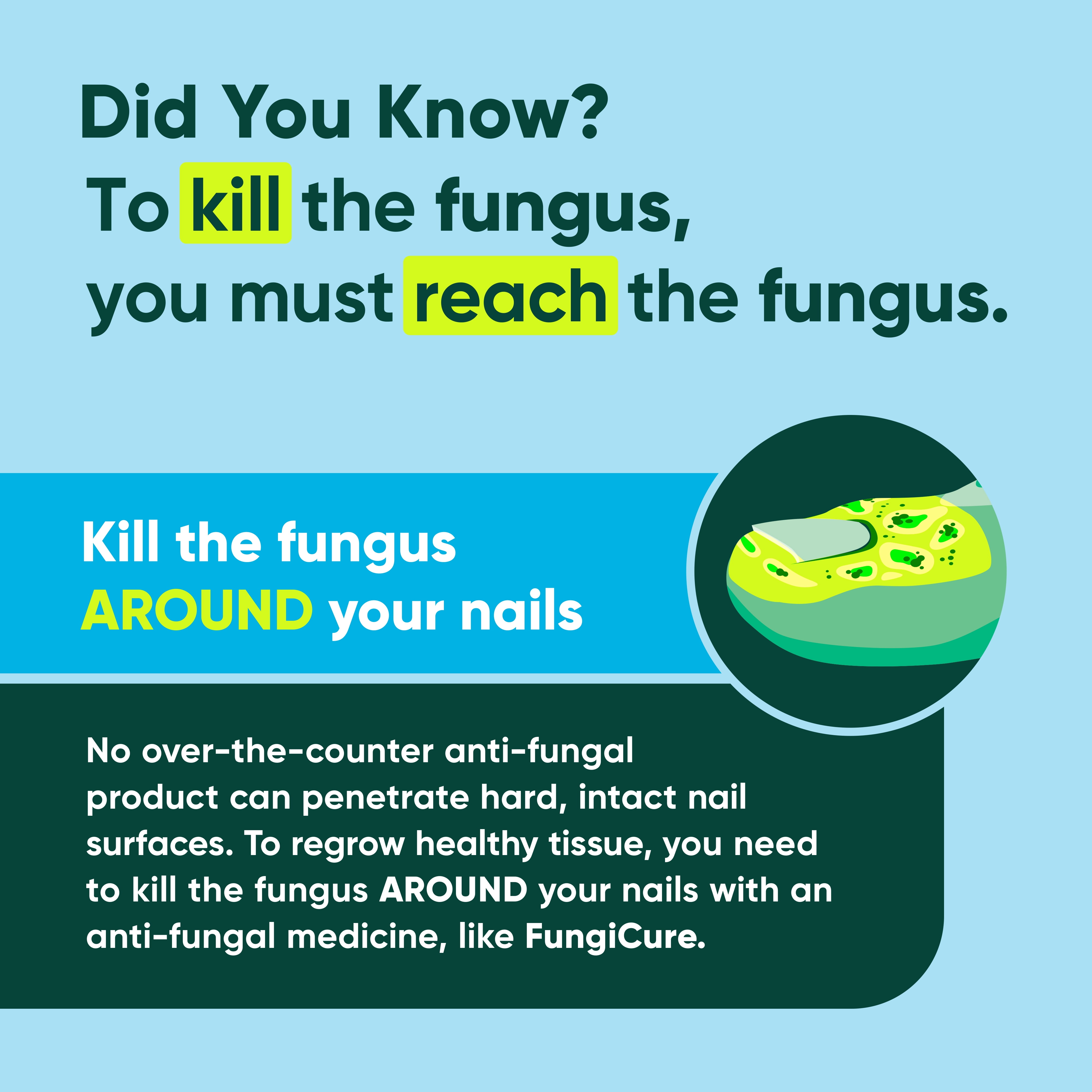 Fungicure Intensive Spray Anti-Fungal Treatment, 2 fl oz, 1 Pack