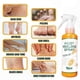 thumbnail image 4 of Exfoliating Foot Spray for Dead Skin Removal with Moisturizing and Whitening Properties 100ml, 4 of 5