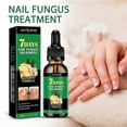 thumbnail image 3 of nail fungus treatment natural formula 7 days, 3 of 5