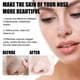 thumbnail image 4 of Blackhead Tearing Nasal Membrane Remove Blackhead Closed Mouth Acne Warm And Clean Suck Out Blackhead, 4 of 4