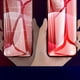 thumbnail image 3 of Película de hidrogel para iPhone, protector de pantalla para iPhone 7, 8, 6 Plus, X, XR, XS MAX, 11, 12, 13 Pro Max, sin cristal, 1-4 unidades, 3 of 3