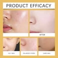 thumbnail image 3 of Esencias de arroz Essence para eliminar arrugas, hidratar, equilibrar agua y grasa, iluminar, refinar los poros, reducir los poros, 30 ml + 30 ml para el cuidado de la piel., 3 of 4