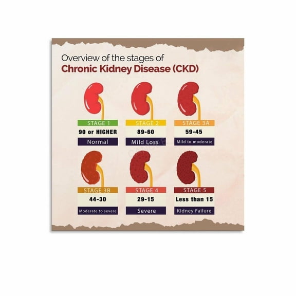 Kidney Function Guid Stages of Kidney Disease Guide Poster Infographic (13) - Walmart.com
