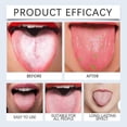 thumbnail image 4 of Tongue Cleaning Gel for Bad Breath & Sensitive Teeth - Natural, Long-Lasting Freshness for Daily Use, 4 of 5