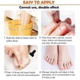 thumbnail image 5 of 2026 Nail Fungal Solution,Nail Repair for Fingernails Toenails, Toe Nail Fungal Treatment Fungal Nail Solution Fixes Nails Safe Effective(30ML), 5 of 5