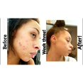 thumbnail image 2 of The Ordinary Retinol 1% in Squalane 1-Pack, 2 of 3