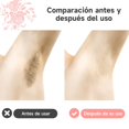 thumbnail image 3 of Calentador de Cera El&eacute;ctrico, Kit Calentador de Cera, con 400 Gramos de Cera Espa&ntilde;ola para Depilacion Spa,Con 20 Esp&aacute;tulas,Nergo, 3 of 8