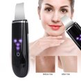 thumbnail image 4 of Instrumento de limpieza facial, depurador de piel ultrasónico, depurador de piel con espinillas, instrumento de limpieza de poros, uso conveniente, 4 of 9