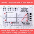 thumbnail image 2 of 5 Reglas de ECG de 7 Pasos para Interpretación de ECG/EKG, Herramienta Rápida de Análisis y Medición Cardíaca, 2 of 5