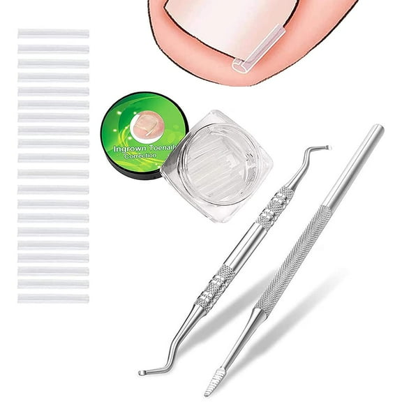 (50 2) Pack Professional Ingrown Toenail Correction Treatment Kit, 50 Pcs Ingrown Toenail Corrector Straightener Strips Recover Clips with 2 Pcs Ingrown Toenail File And Lifter