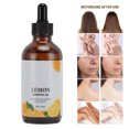 thumbnail image 3 of Aceites Esenciales De Limón, Aceite De Masaje Corporal Multiusos De Aromaterapia Refrescante De 118ml Para La Cara, 3 of 7