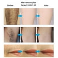 thumbnail image 4 of Hair Growth Inhibitor 50ml Upgraded,Hair Stop Growth Spray,Non-Irritating Painless Hair Inhibitor Spray for Body and Face,Underarm,Arm,Leg for Men and Women, 4 of 7