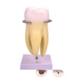 thumbnail image 1 of LOVEVER Human Tooth Model Molar Tooth Anatomy Model Teeth Model, 1 of 13