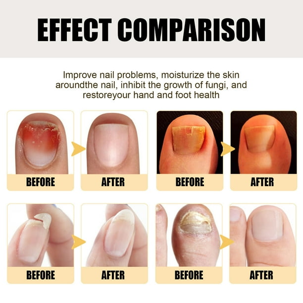 Nail Care for Men: Essential Tips for Strong, Healthy Nails