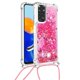 thumbnail image 4 of Funda FOXDOCK para Xiaomi Redmi Note 11/11s 4G con Cuerda Ajustable, Brillo Líquido, Protección Antigolpes y Lente – Ideal para Regalo, 4 of 6